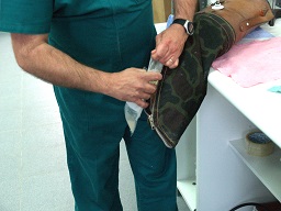 Extracción de Semen