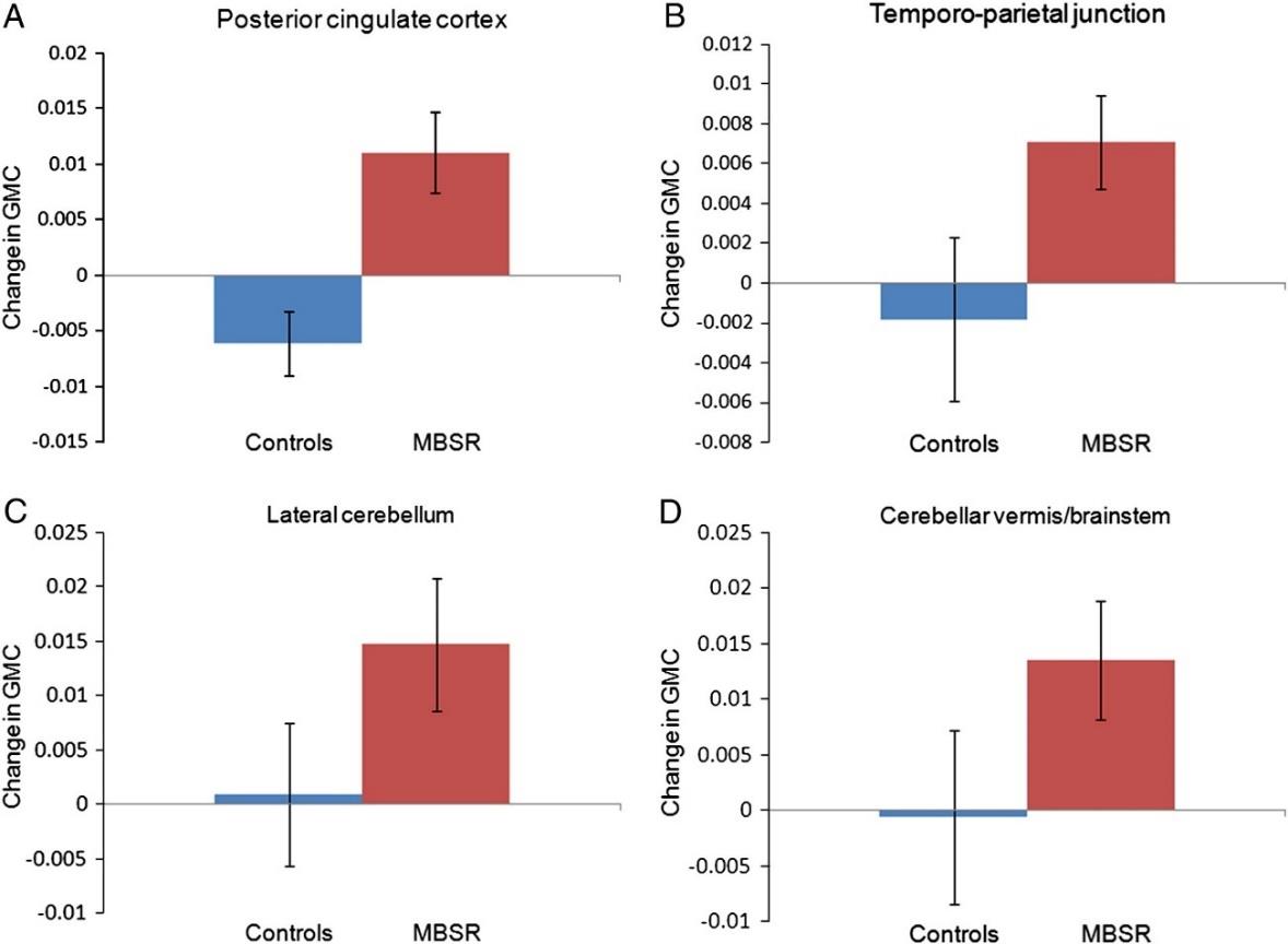 Cambio de concentración de materia gris (GMC)